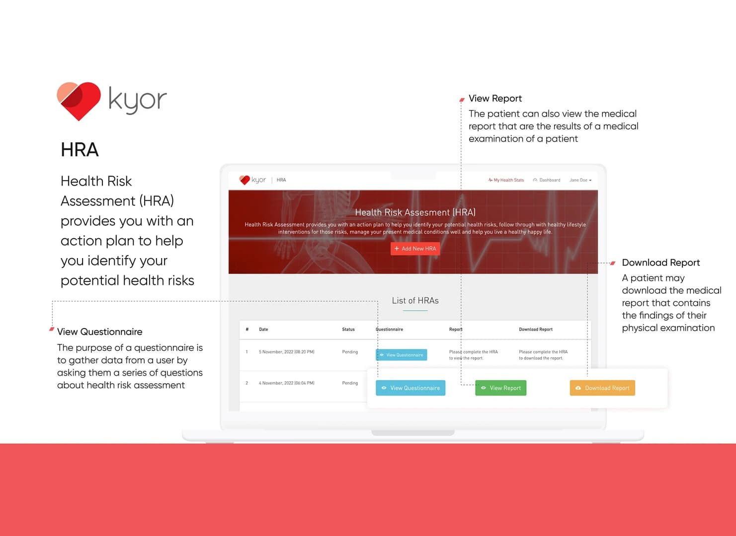 Kyor
